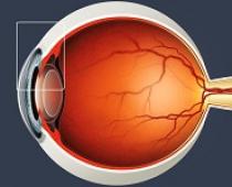 Основні причини порушення зору та заходи профілактики очних захворювань