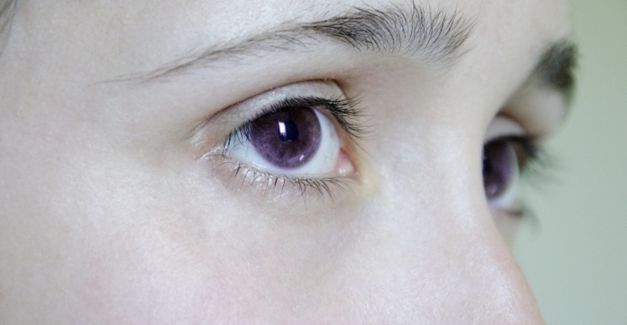 Augenfarbe die seltenste was ist SELTENSTE AUGENFARBE